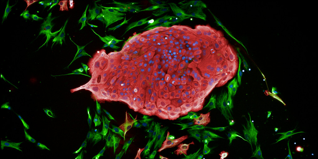 Inventro fluorescence microscopy: a red-stained cell cluster surrounded by green-stained cells, with nuclei in blue.